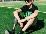 Lauren Wasser : Amputée à cause de son tampon hygiénique, elle perd sa 2e jambe