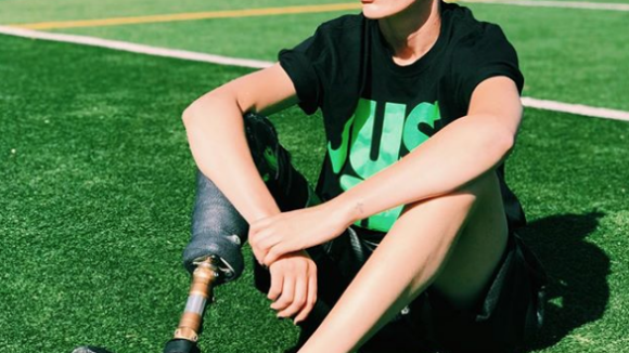 Lauren Wasser : Amputée à cause de son tampon hygiénique, elle perd sa 2e jambe
