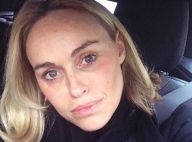 Cécile de Ménibus "brûlée au 3e degré" : Elle partage son calvaire