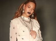 Beyoncé mordue au visage par une actrice "droguée", la folle anecdote !