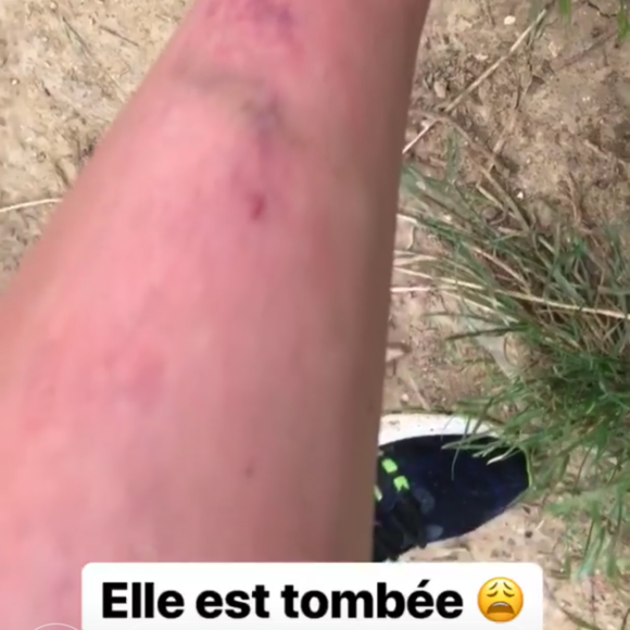 Ariane Brodier blessée - 6 juin 2018