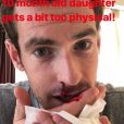 Andy Murray blessé au nez par sa fille de 10 mois, le 28 août 2018.