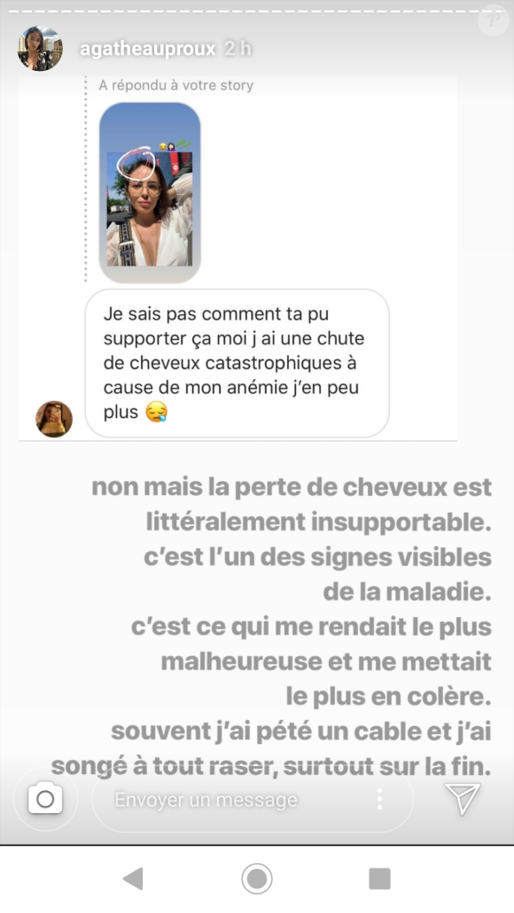 Agathe Auproux évoque sa perte de cheveux liée à la chimiothérapie sur Instagram, le 11 juillet 2019.
