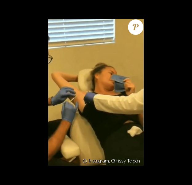 Chrissy Teigen se fait injecter du botox dans les aisselles. Août 2019.