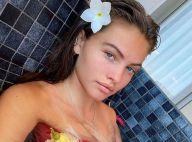 Thylane Blondeau : "La bave d'escargot a sauvé ma peau"