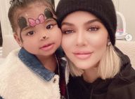 Khloe Kardashian transformée, son nouveau visage surprenant