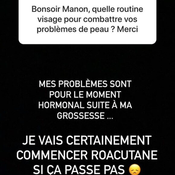 Manon Marsault, sa décision radicale pour ne plus souffrir de l'acné.