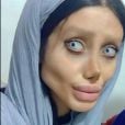 Sahar Tabar, une jeune fan iranienne, fait tout pour ressembler à Angelina Jolie. Selon la presse, elle aurait subi jusqu'à 50 opérations de chirurgie esthétique. Novembre 2017.