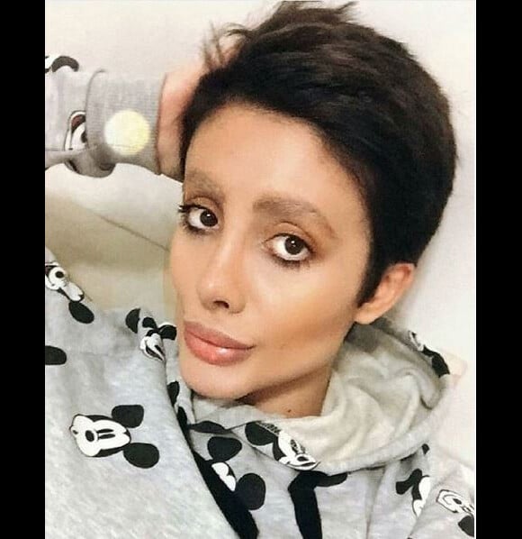 Sahar Tabar, avant ses opérations de chirurgie esthétique. Décembre 2017.