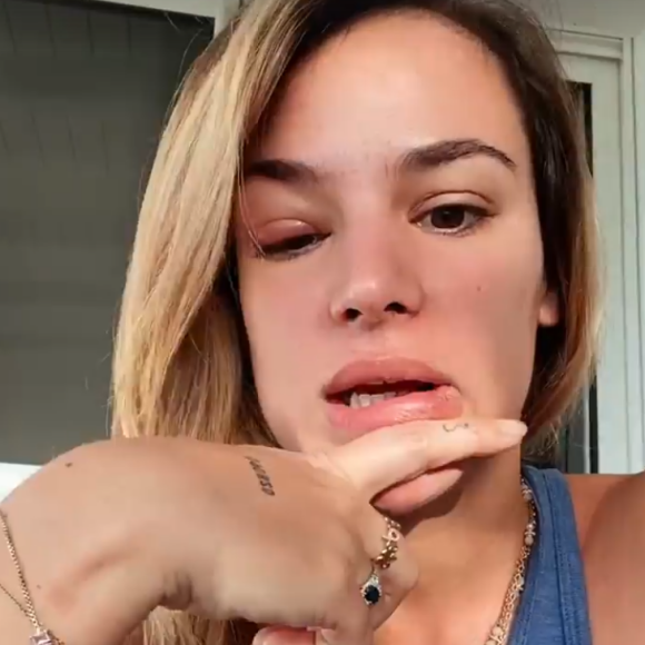 Jade Leboeuf dévoile son oeil très gonflé sur Instagram - 14 janvier 2021