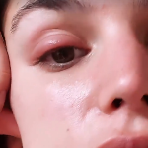 Jade Leboeuf dévoile son oeil très gonflé sur Instagram - 14 janvier 2021