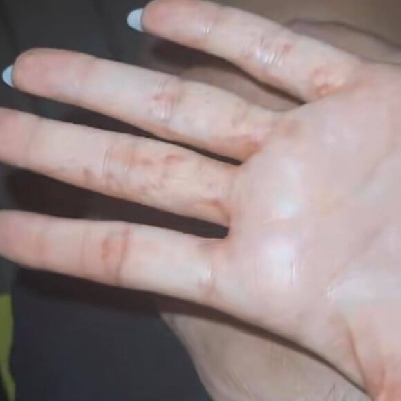 Thomas Vergara dévoile les boutons de Nabilla sur Snapchat le 6 août 2021.