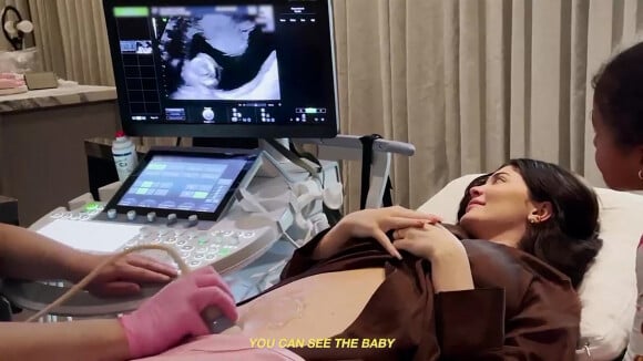 Kylie Jenner en échographie lors de sa deuxième grossesse.