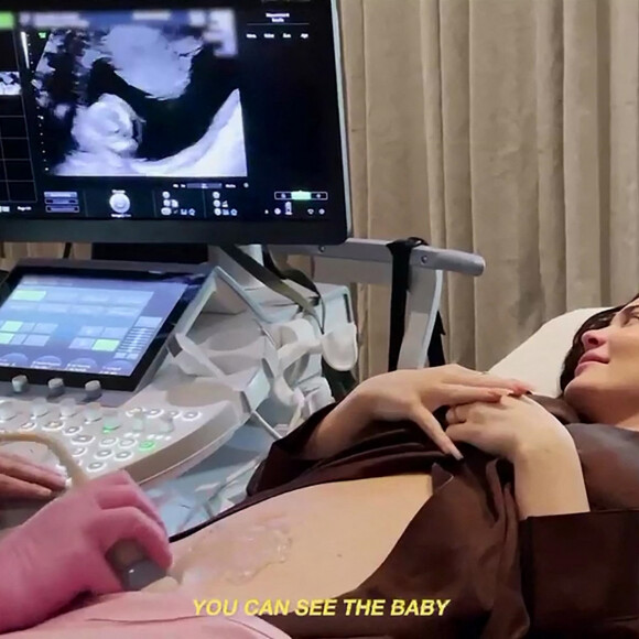Kylie Jenner en échographie lors de sa deuxième grossesse.