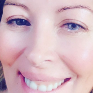 Loana partage une photo sur laquelle elle dévoile ses yeux vairon - Instagram