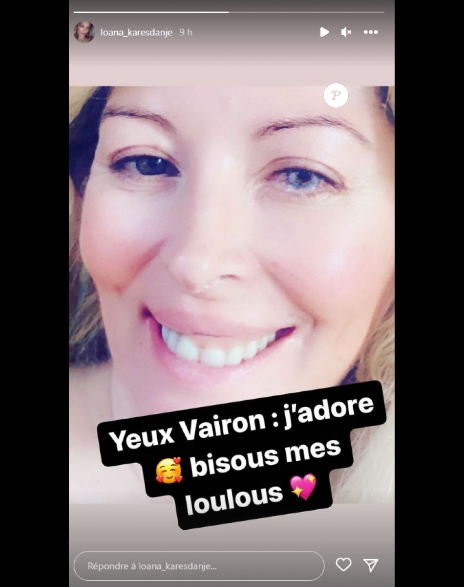 Loana partage une photo sur laquelle elle dévoile ses yeux vairon - Instagram