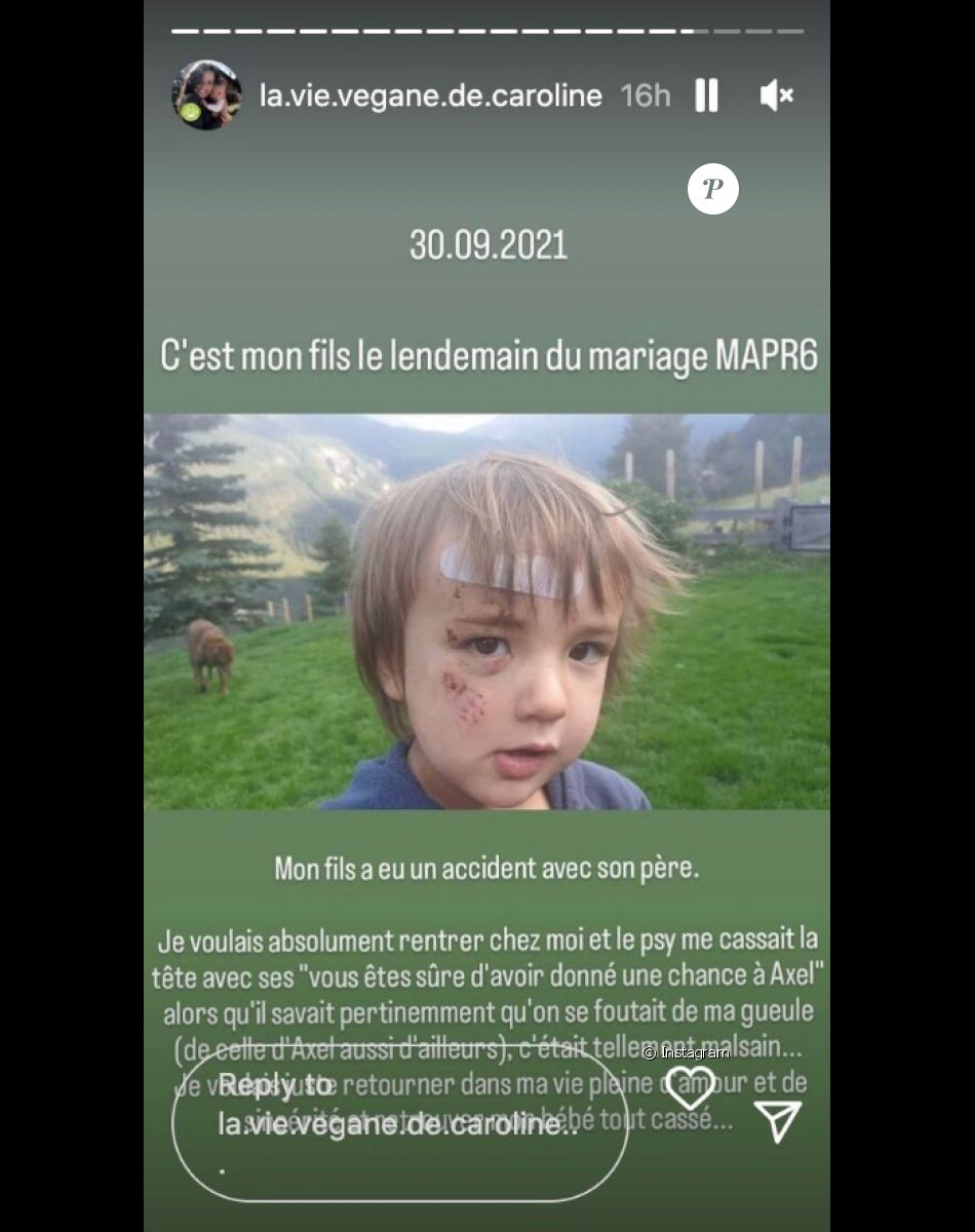 Caroline (Mariés au premier regard) partage une photo choc de son fils blessé - Instagram