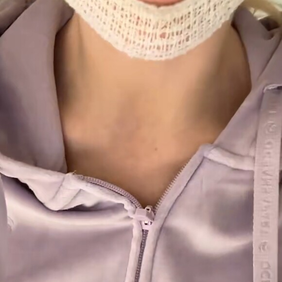 Jessica Thivenin se dévoile après sa nouvelle opération de chirurgie esthétique