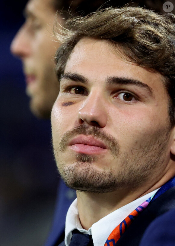 Le professeur Frédéric Lauwers a opéré le rugbyman français
Antoine Dupont - Femmes de joueurs et joies à l'issue du match de Coupe du monde de rugby entre la France et l'Italie (60-7) à Lyon le 6 octobre 2023. © Cyril Moreau-Dominique Jacovides/Bestimage