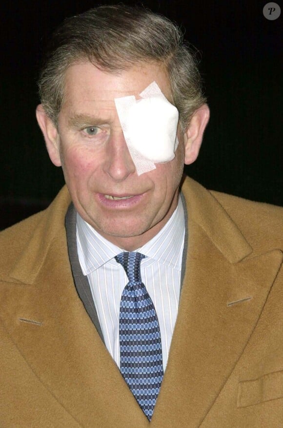 Il s'était, par exemple, retrouvé avec un patch de pirate sur l'oeil gauche après avoir scié un arbre de son jardin.
Prince Charles - Soirée de la Fondation des artistes bénévoles à Twickenham.