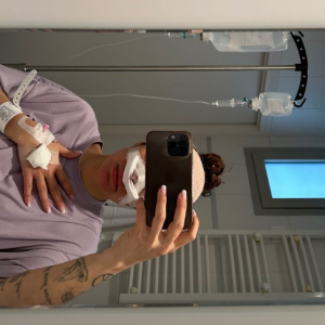 Une opération du nez qui fait suite à son agression survenue en novembre 2023.
Anaïs Camizuli a subi une opération du nez suite à sa violente agression survenue en novembre 2023. Instagram