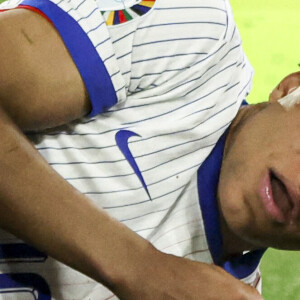 L'attaquant des Bleus s'est fracturé le nez et porter un masque est apparemment une corvée

Kylian Mbappé a été victime d'une fracture du nez lors du match du groupe D de l'Euro 2024 entre l'équipe de France et l'Autriche (1-0) à Dusseldorf en Allemagne le 17 jun 2024. Sorti avec le nez cassé après un choc avec Kevin Danso, Kylian Mbappé a passé des premiers examens qui laissent place à l'optimisme. L'intervention chirurgicale est écartée " dans l'immédiat ", selon la FFF.