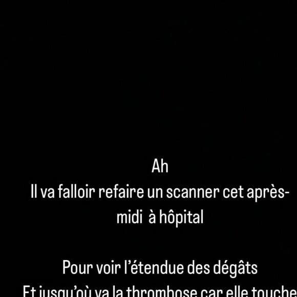 Dont un scanner ce jeudi 18 juillet "pour voir l'étendue des dégâts" car la thrombose "touche des grosses veines" et fait souffrir Alexandra Rosenfeld
Alexandra Rosenfeld hospitalisée à cause d'une thrombose veineuse