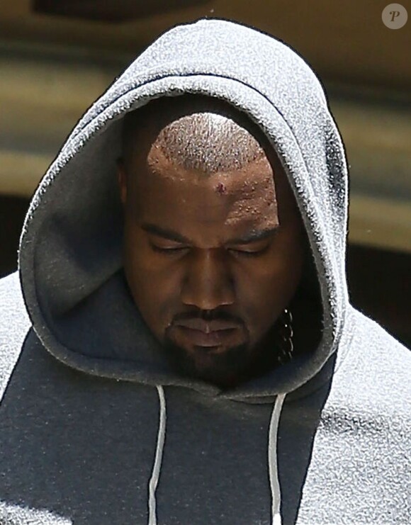 Kanye West sort de chez Kim Kardashian avec une blessure au front le 11 mai 2013 à Los Angeles