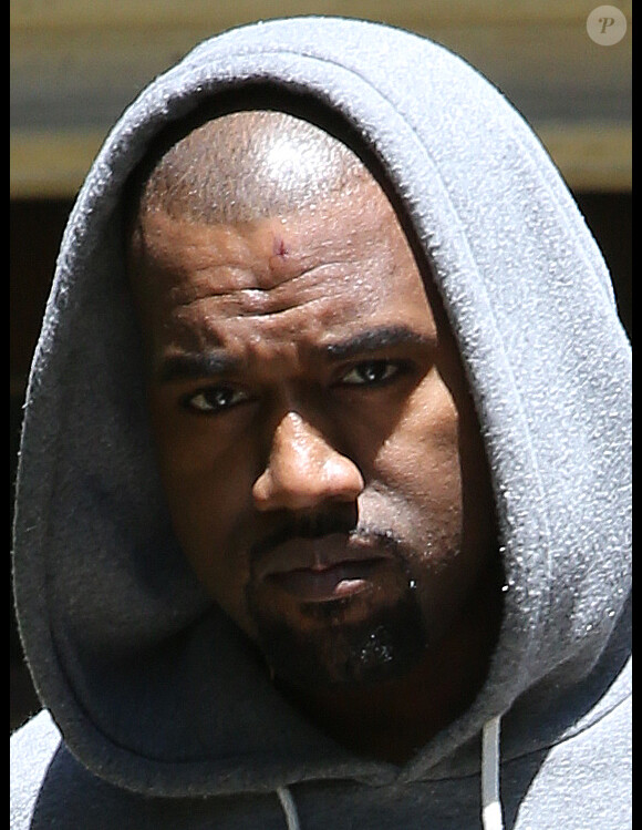 Kanye West, blessé au front après s'être cogné contre un panneau de signalisation. Beverly Hills, le 11 mai 2013.