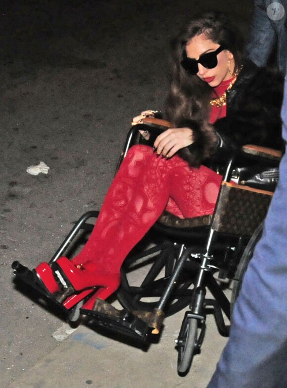 Exclusif - Lady Gaga blessée le 29 mars 2013.