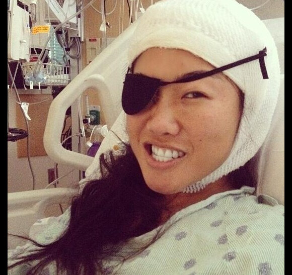 Atteinte d'une tumeur au cerveau, Julie Chang a ouvert les portes de sa lourde opération.