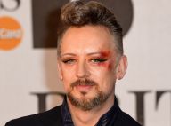 Boy George en sang aux Brit Awards 2014 ? Son nouveau look étonnant