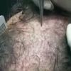 Julien Lepers découvre une vidéo filmée pendant qu'il se faisait implanter des cheveux. Emission "Salut les terriens !" du samedi 5 avril 2014.