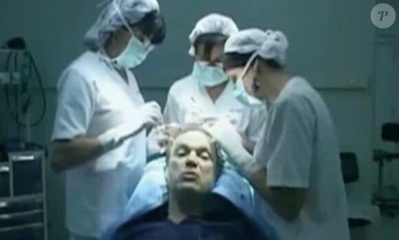 Julien Lepers découvre une vidéo filmée pendant qu'il se faisait implanter des cheveux dans l'émission "Salut les terriens !" du samedi 5 avril 2014.