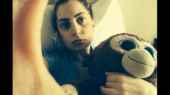 Lady Gaga, hamster triste : La Mother Monster aussi gère mal l'après-dentiste