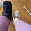 Véronique Genest, le pied dans le plâtre après sa blessure dans L'oeuf ou la poule