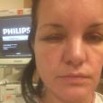  Pauley Perrette, défigurée par une allergie à sa teinture, image publiée sur son compte Twitter le 19 juillet 2014 