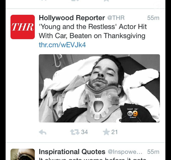 L'acteur et mannequin Corey Sligh se vante de faire la Une du Hollywood Reporter avec ses blessures. 2014.