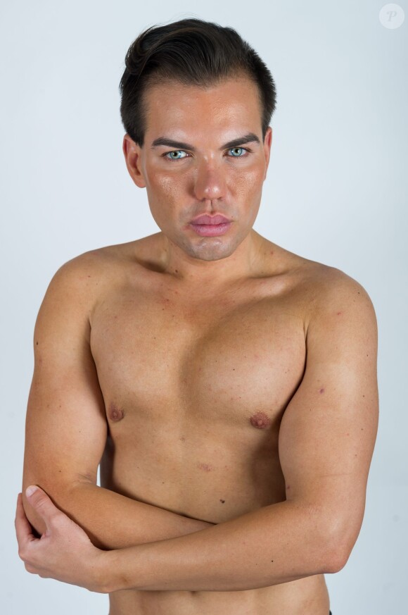 Le brésilien Rodrigo Alves âgé de seulement 31 ans a déjà subi plus d'une trentaine d'opérations de chirurgie esthétique. De nombreux actes médicaux qui ont failli lui coûter la vie puisqu'il est déjà resté paralysé et incapable de se nourrir ou de se laver. Toutefois il jure pour l'instant de ne jamais s'arrêter. 