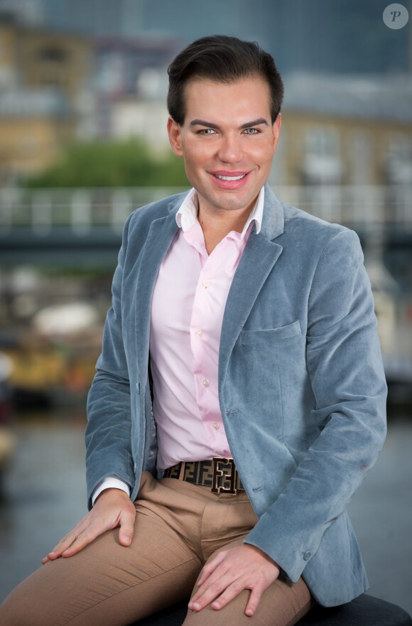 Le brésilien Rodrigo Alves âgé de seulement 31 ans a déjà subi plus d'une trentaine d'opérations de chirurgie esthétique. De nombreux actes médicaux qui ont failli lui coûter la vie puisqu'il est déjà resté paralysé et incapable de se nourrir ou de se laver. Toutefois il jure pour l'instant de ne jamais s'arrêter. 