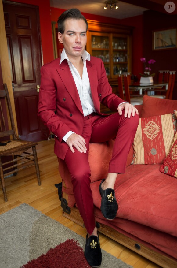 Le brésilien Rodrigo Alves âgé de seulement 31 ans a déjà subi plus d'une trentaine d'opérations de chirurgie esthétique. De nombreux actes médicaux qui ont failli lui coûter la vie puisqu'il est déjà resté paralysé et incapable de se nourrir ou de se laver. Toutefois il jure pour l'instant de ne jamais s'arrêter. 