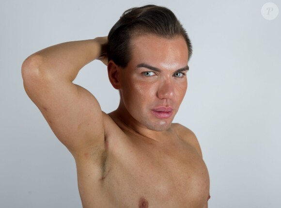 Le brésilien Rodrigo Alves âgé de seulement 31 ans a déjà subi plus d'une trentaine d'opérations de chirurgie esthétique. De nombreux actes médicaux qui ont failli lui coûter la vie puisqu'il est déjà resté paralysé et incapable de se nourrir ou de se laver. Toutefois il jure pour l'instant de ne jamais s'arrêter. 