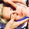Miley Cyrus encadre son visage de glace après son opération des dents de sagesse, sur Instagram le 26 mars 2015