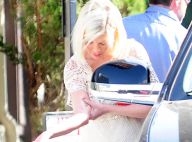 Tori Spelling hospitalisée : Gravement brûlée, elle subit une greffe de peau
