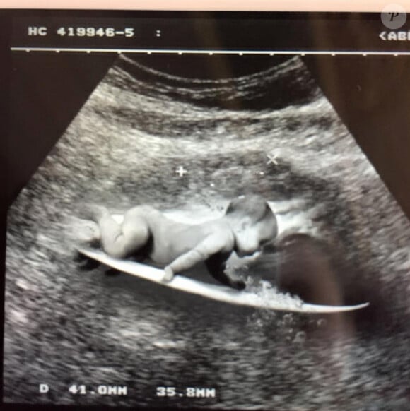 Natasha St-Pier est enceinte de son premier enfant. Elle annonce la bonne nouvelle sur Facebook. Mai 2015.