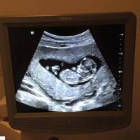 Michael Bublé, futur papa enthousiaste, dévoile une première échographie du bébé