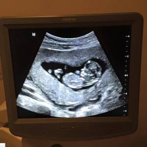Michael Bublé a posté la photo de l'échographie de son futur bébé sur Instagram / juillet 2015