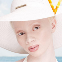 Thando Hopa : Albinos et mannequin star, elle rayonne sur la modosphère