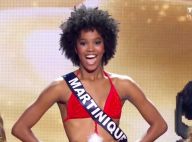 Miss France 2016 - Miss Martinique : Son passé très hot refait surface...