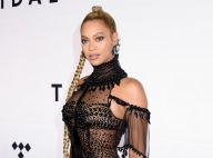 Beyoncé, déesse très glamour : Même blessée, elle assure le show !